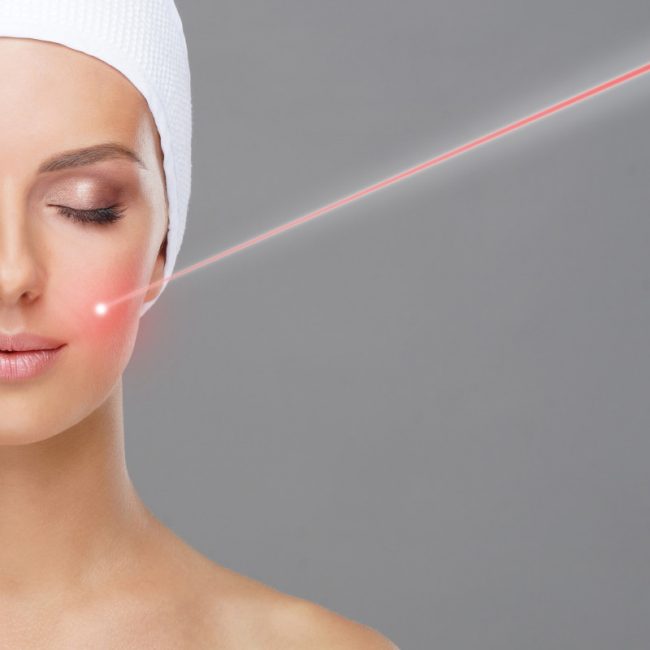 laser co2 cirugia estética