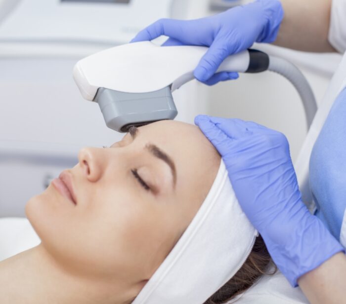 fotorejuvenecimiento belleza
