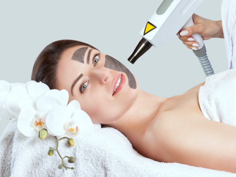 carbon peel flash laser Synchro QS4