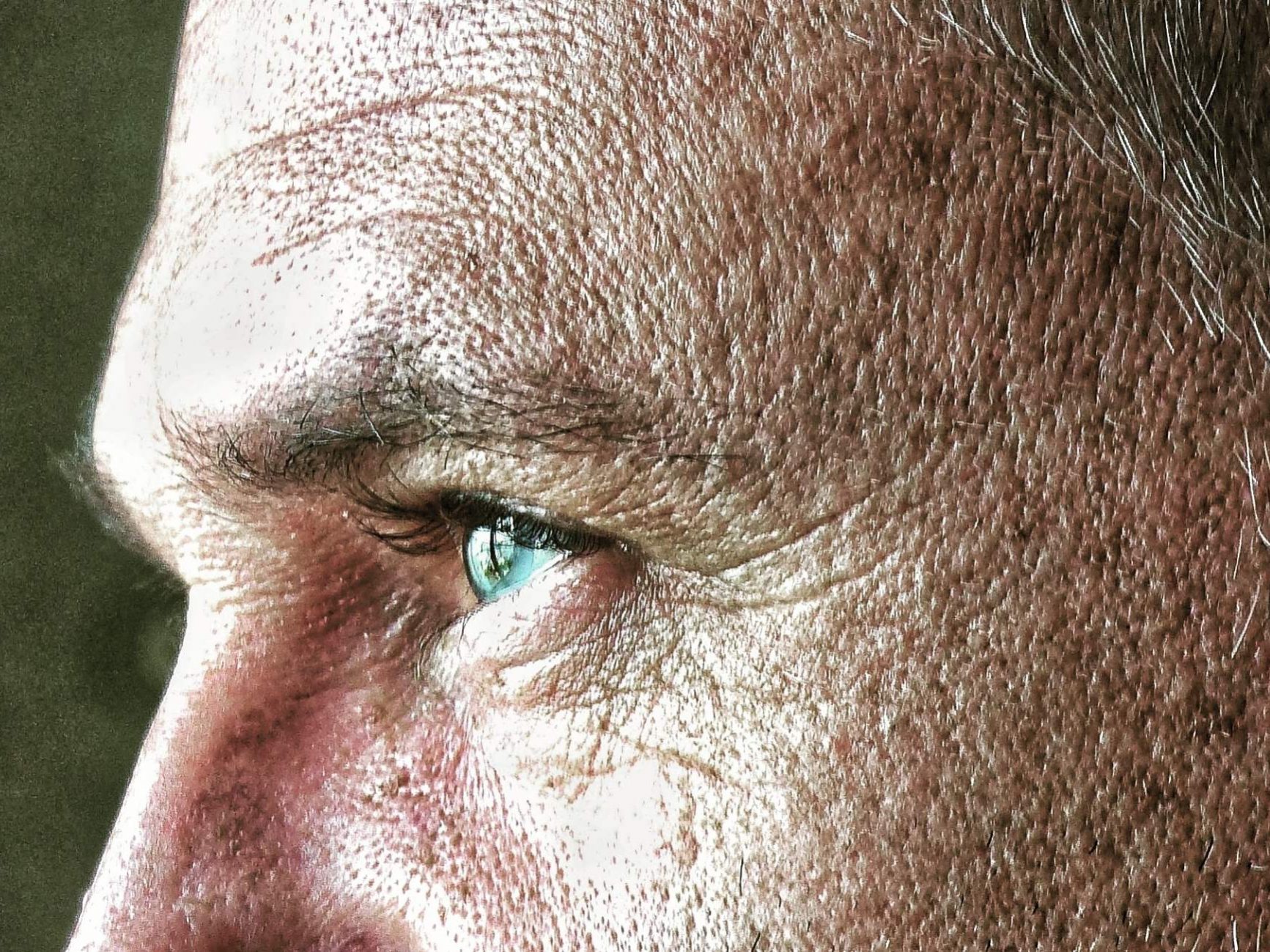 eliminar arrugas en hombres