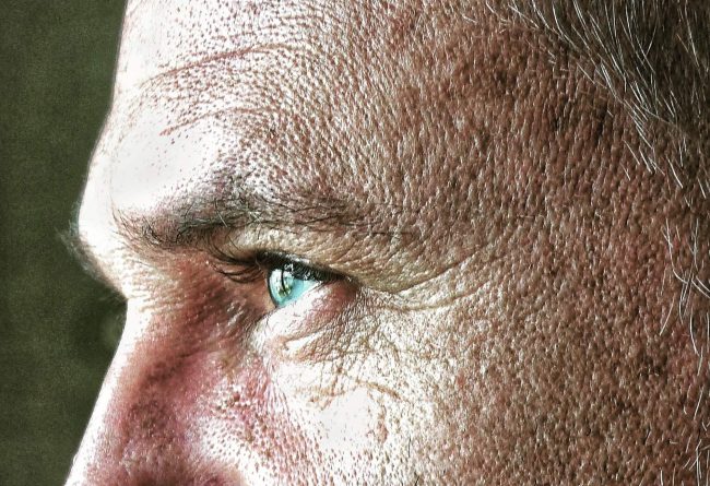 eliminar arrugas en hombres