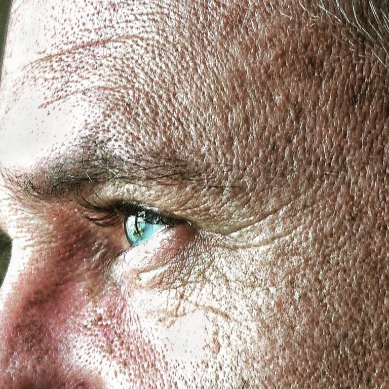 eliminar arrugas en hombres