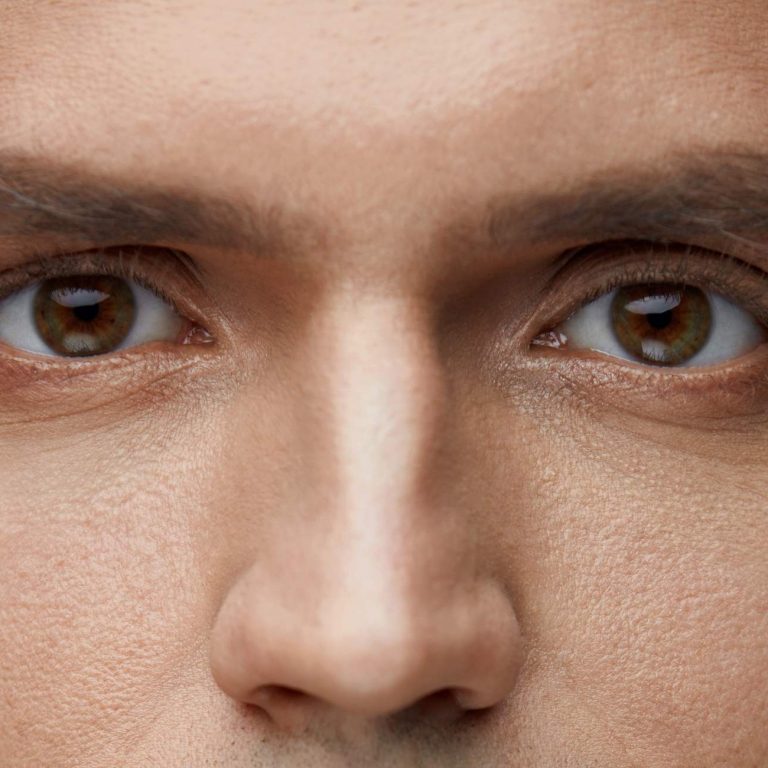 eliminar bolsas y ojeras en hombres estética masculina