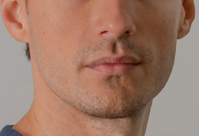 masculinización facial para hombres mandíbula mentón