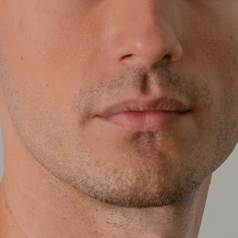 masculinización facial para hombres mandíbula mentón