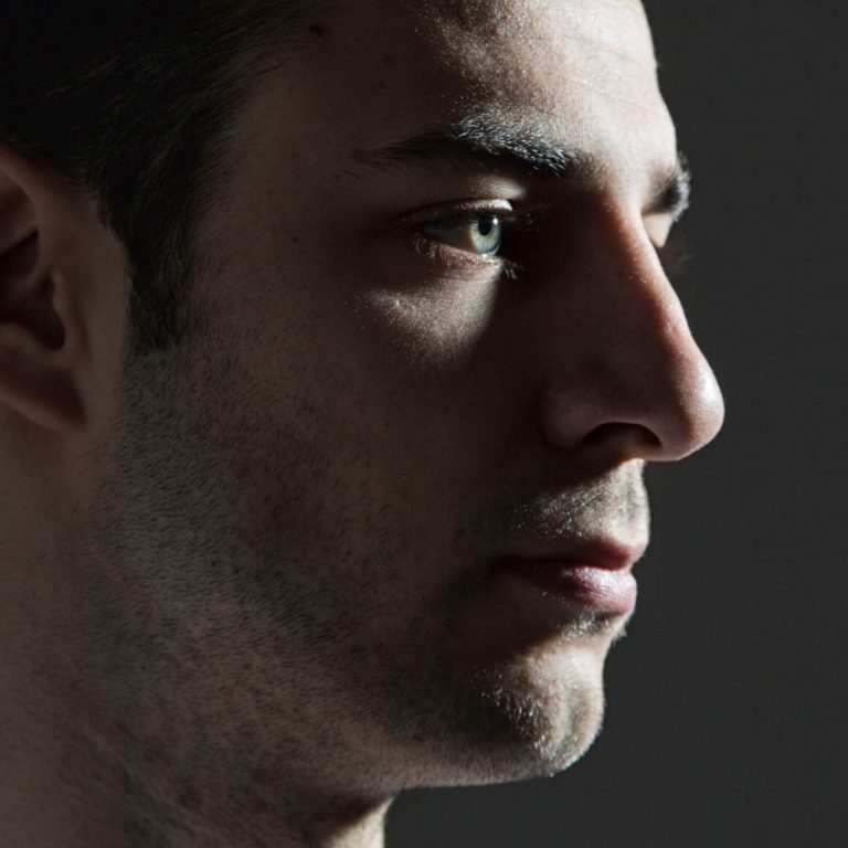 rinomodelación para hombres arreglar la nariz sin cirugía