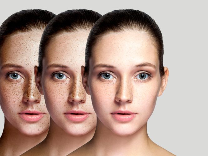 manchas de la piel dermatología estética