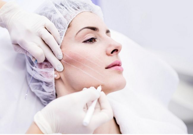 corregir-la-flacidez-facial flacidez facial