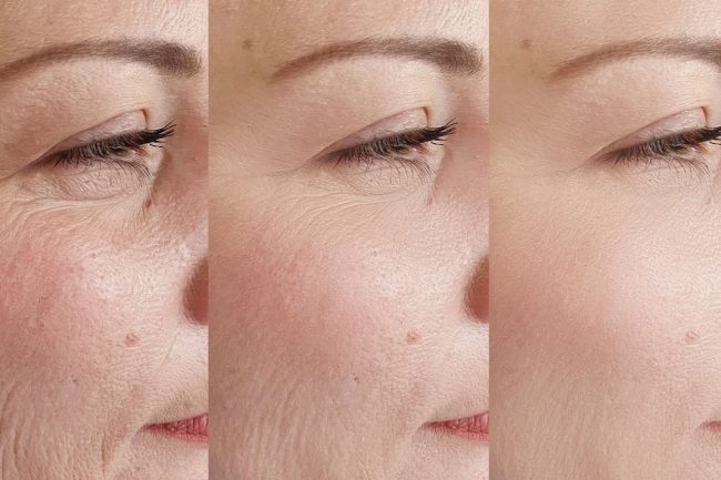 principales preocupaciones estéticas de las españolas según su edad