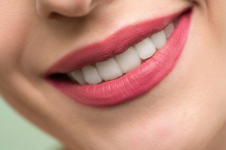 Cómo corregir la sonrisa gingival