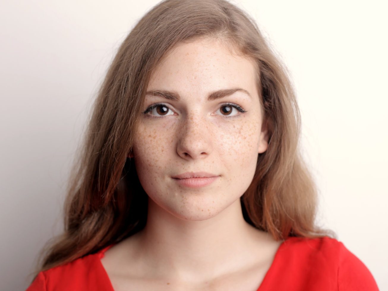 cómo eliminar las manchas en verano