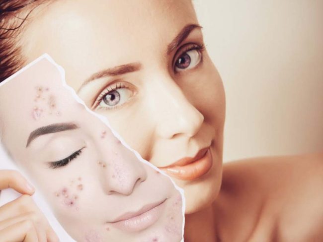 los radicales libres y el estrés oxidativo