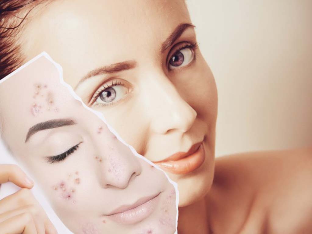 los radicales libres y el estrés oxidativo