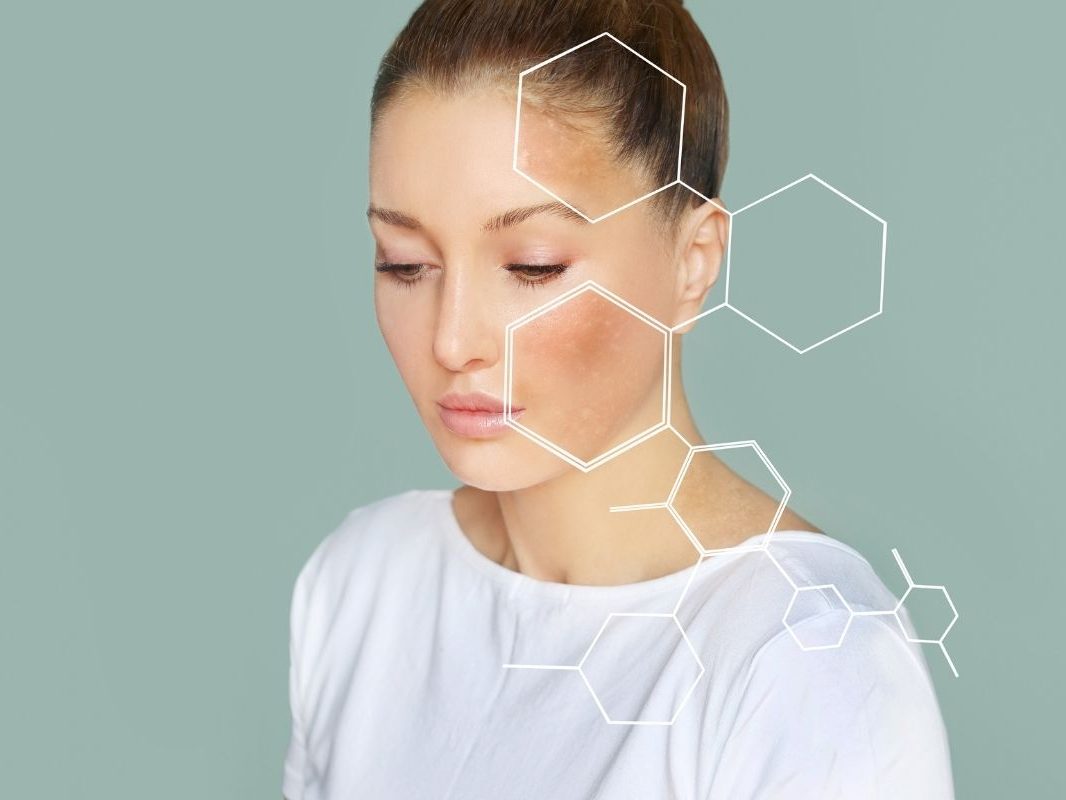 tratar las manchas de la piel