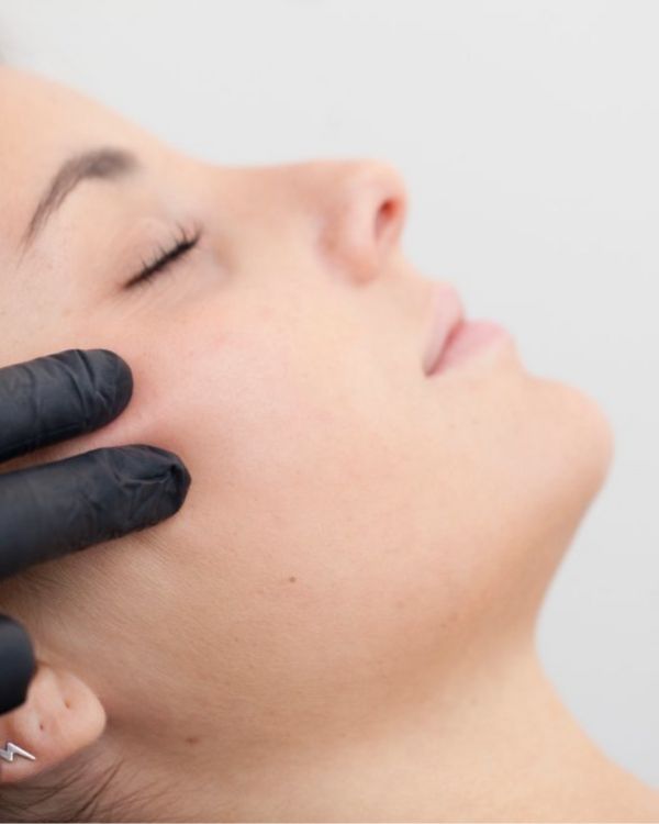 flacidez facial tratamientos