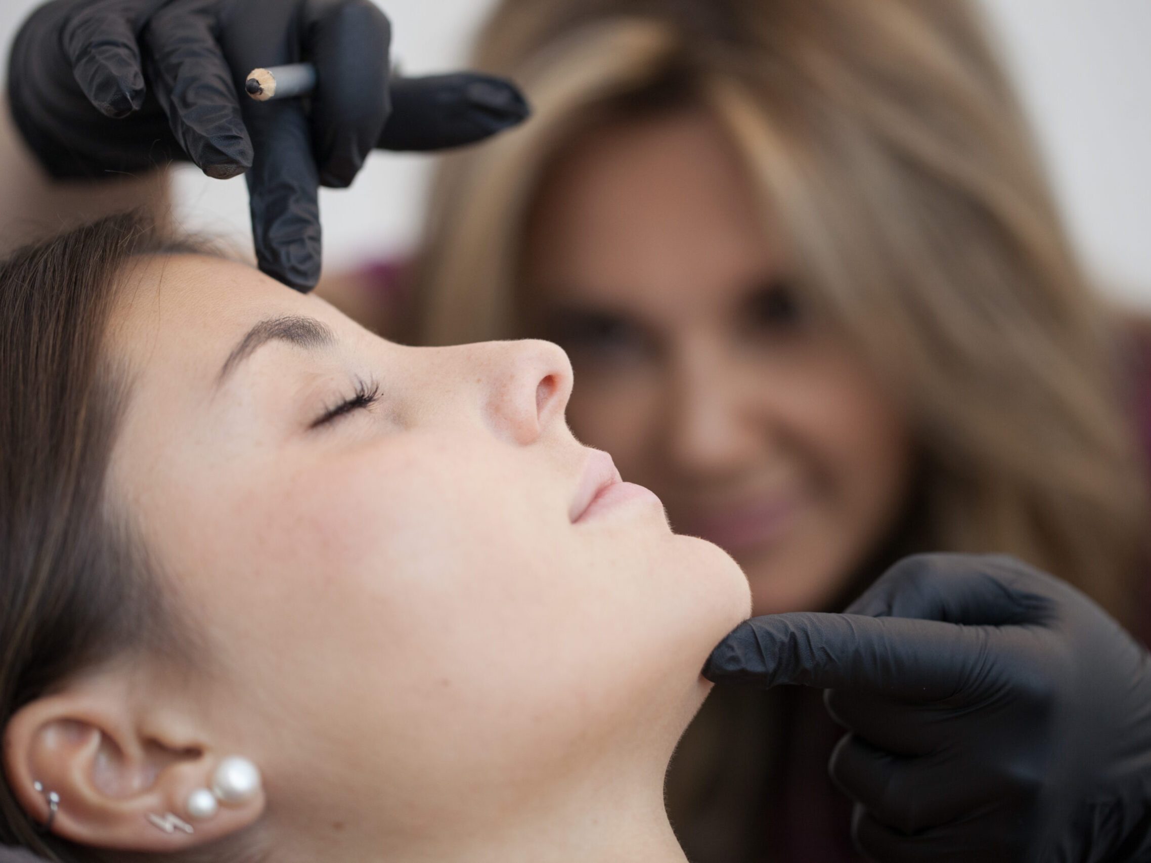 qué es el neolifting