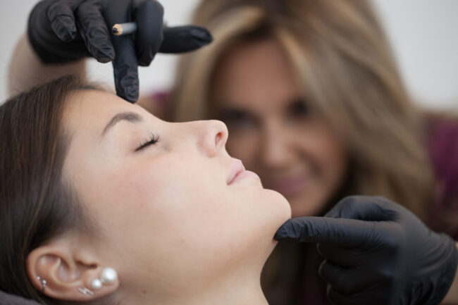 Gema_Clínica_previos_dia2_007 qué es el neolifting